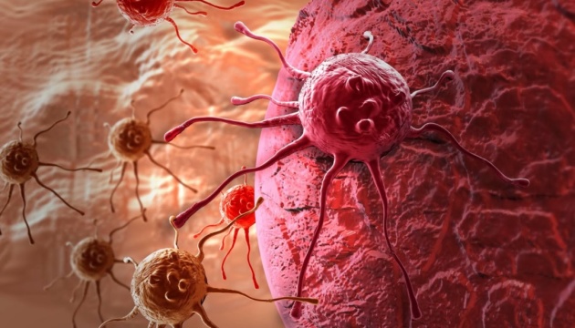П'ять фактів про рак підшлункової залози