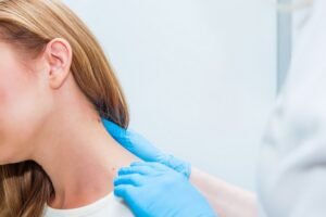 Чому з'являються родимки