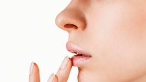 Чому сохнуть губи