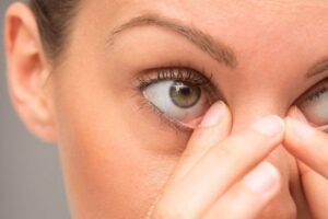 Чому сверблять очі