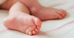 Чому лущиться шкіра на ногах у дитини