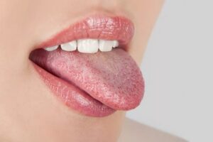 Чому язик може бути білим