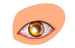 Чому червоні очі